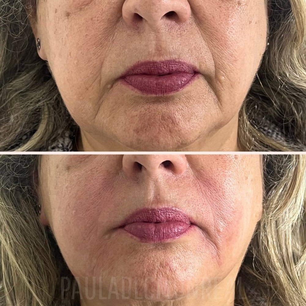 465138957_17966217809803477_676151020439894115_n-r6kohmt447zrsnv505xc1ukuzhbtkf5fegt6m4f1g0