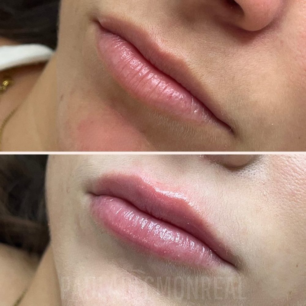 468326160_17969373536803477_4699867944430676986_n-r6kohtdzg28s1xlkxqrq1ax356fe2avjrddkz25a8g