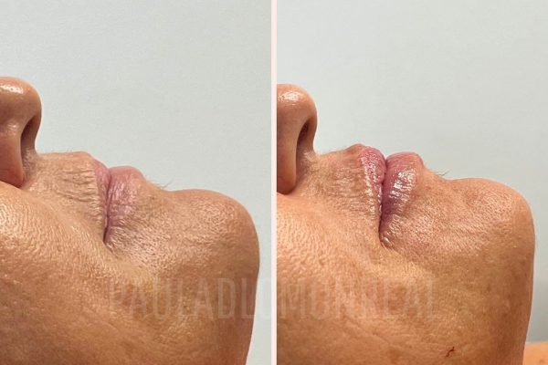 468337052_17969372189803477_7913309624197051907_n-r6koic6mdbrn4xirk62nwn4u3u3t5g4xrt2xx2ekkg