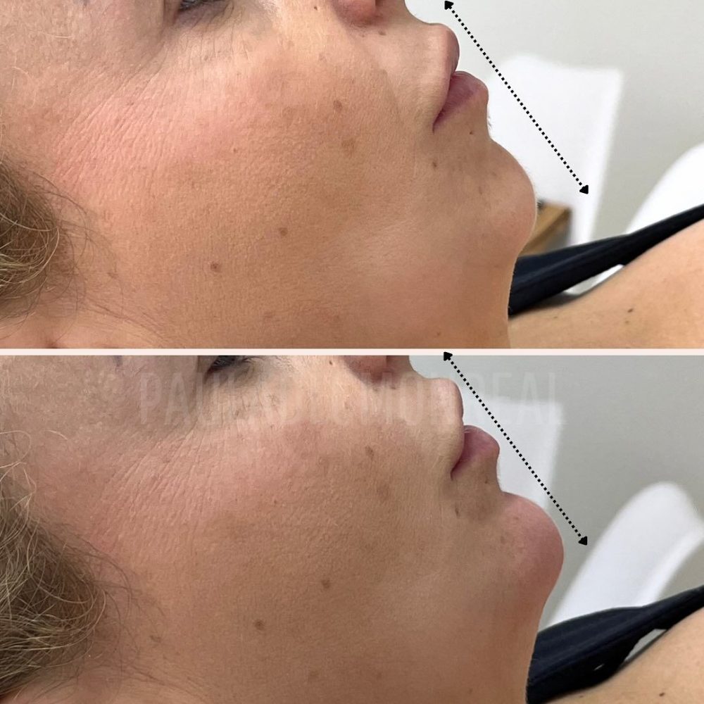 468353402_17969372462803477_2709856124590555174_n-r6koi5lvwwpi8v3tye1vfpu2v6r5ud8251uw7nn5zk (1)