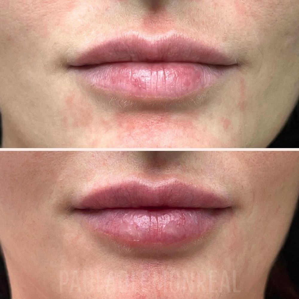 468362091_17969372531803477_8515016302535498462_n-r6koi6jq3qqskh2gswgi07ljgkmj22bsh6idoxlrtc (1)