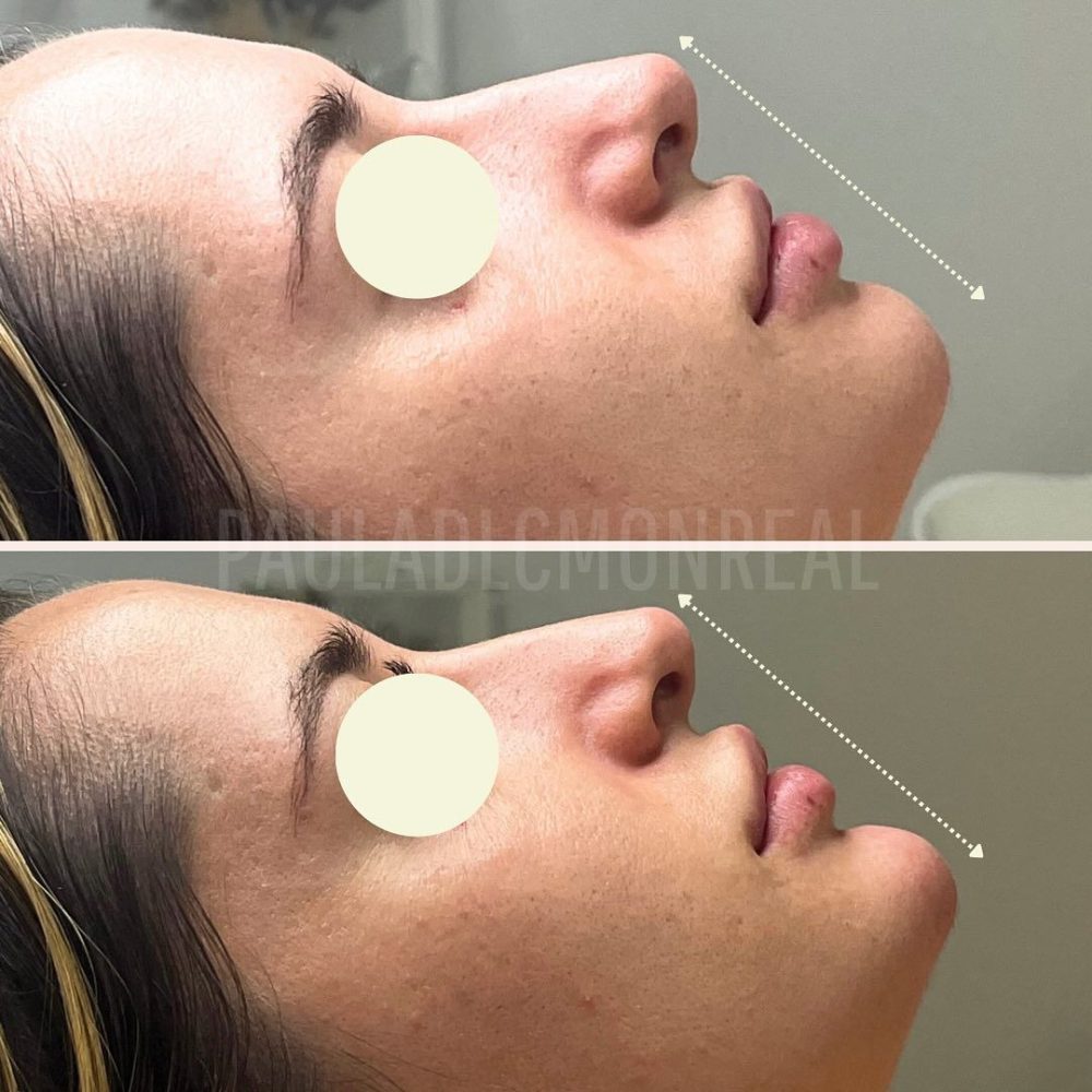 468408786_17969372507803477_2842381723296968071_n-r6kohooshw2cfvsep6ql6u3s692jztcw2q45koc93k