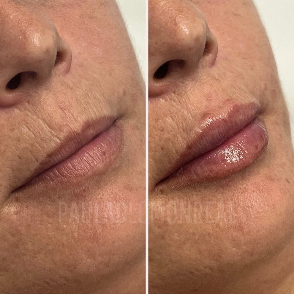 468410151_17969373680803477_5877434703669071397_n-r6kohz10l2ghzlde0t7hg9huphnlchhxs5ahupwx74