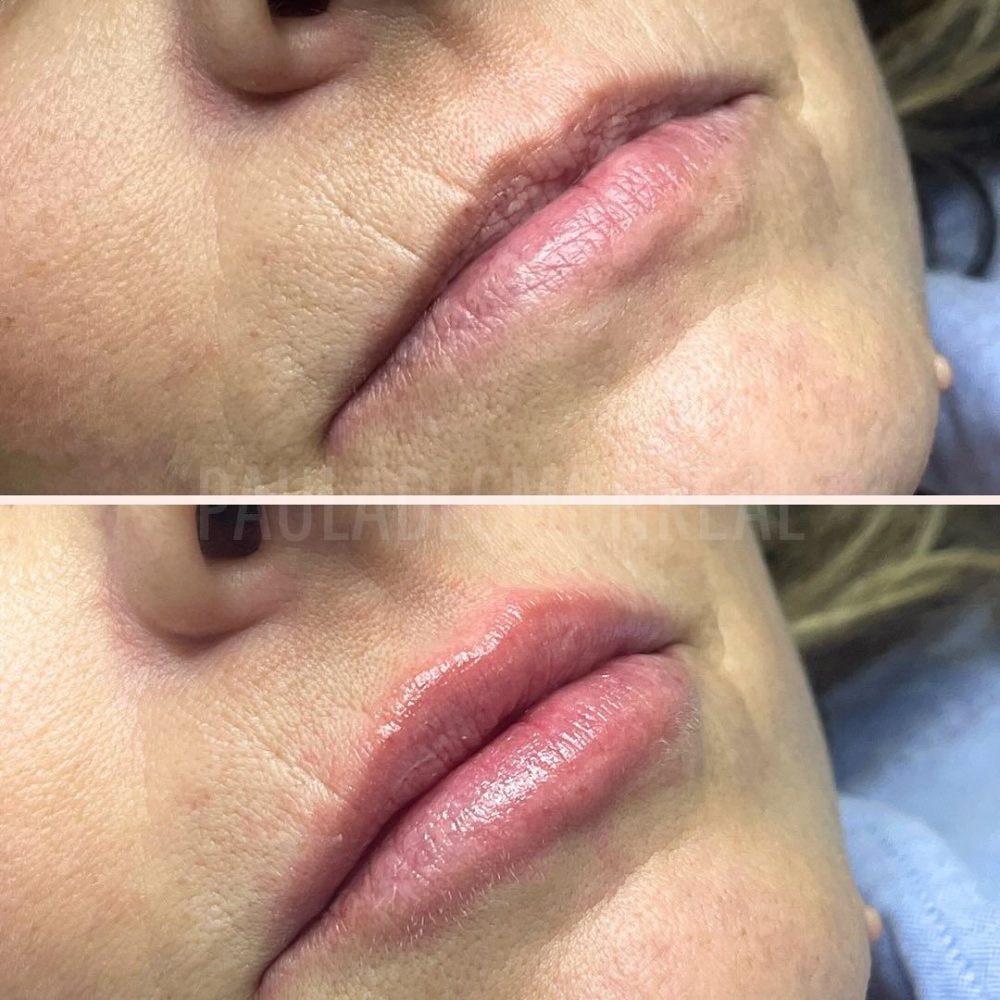 468668504_17969976314803477_5382672317441510940_n-r6kohnqyb21249truobymccbkv76s495qlgo3edn9s