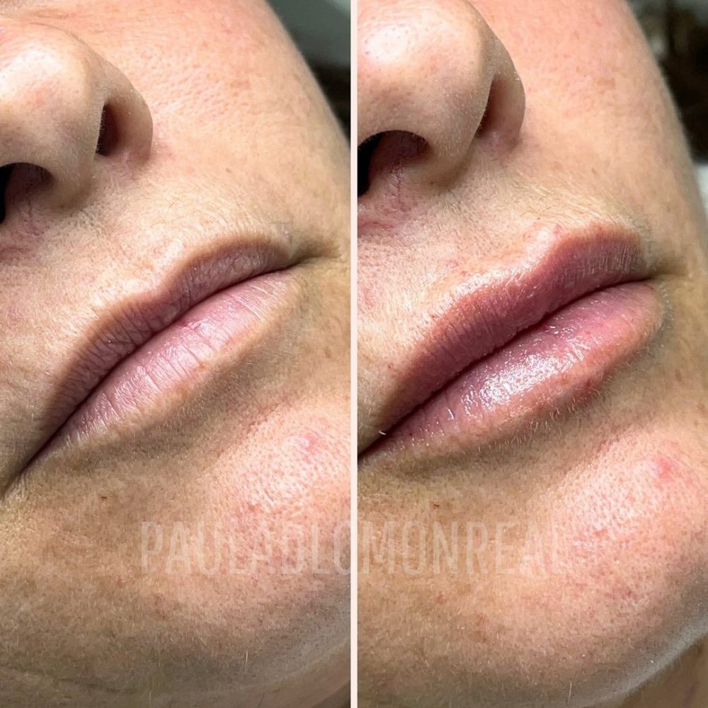 473674865_17975608436803477_1529109139262873519_n-r6kohrib2e67epob8pygwbe5yeonmwo3342m0i82kw