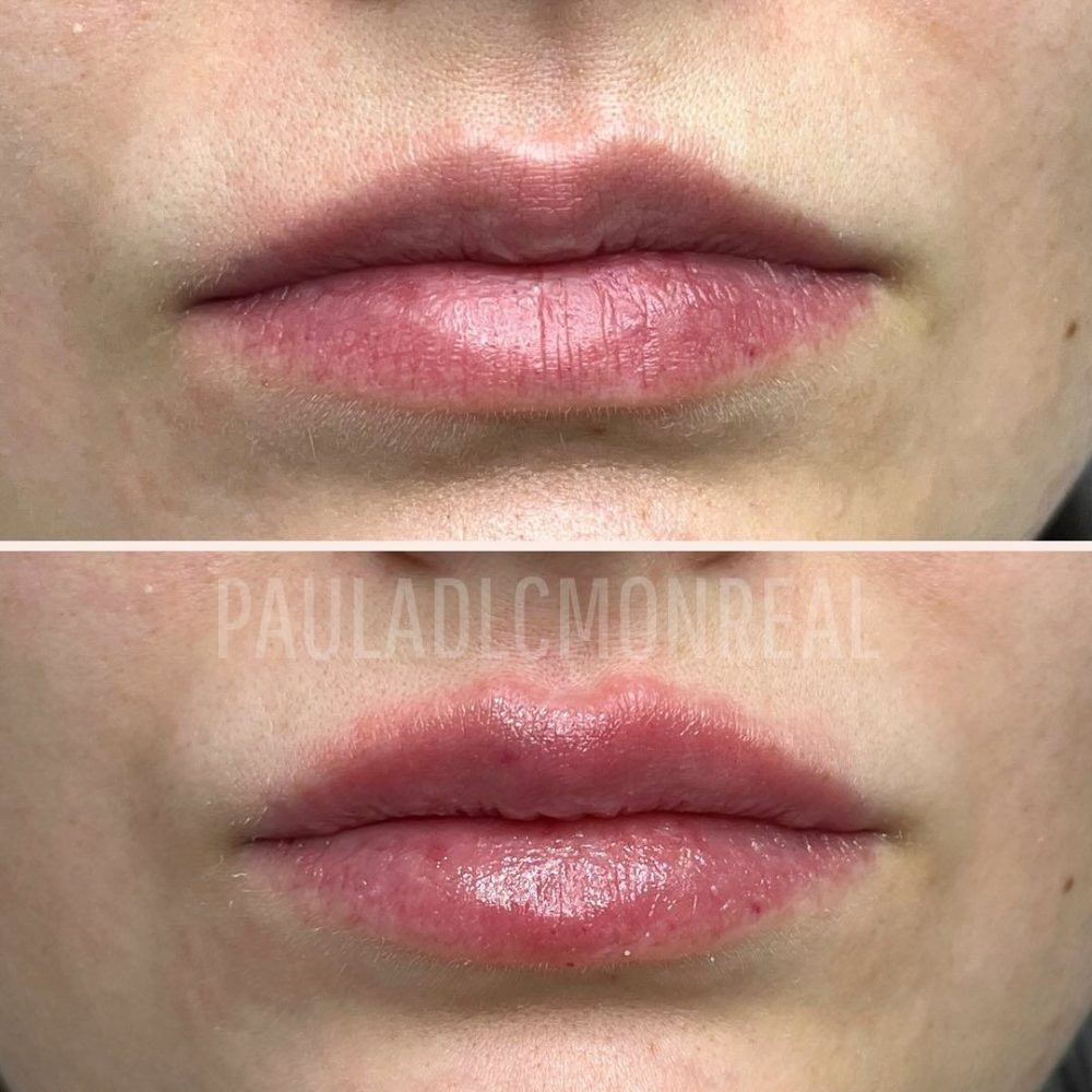 473777061_17975714636803477_8691855152350433611_n-r6koi2sdcelna17xeutzq8jp315279wv4nwfrtrci8