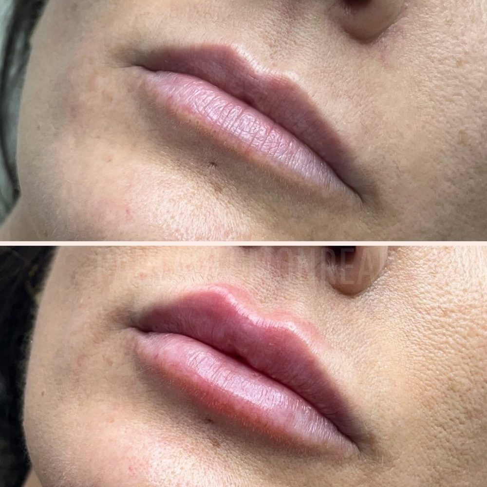 476307402_17978255153803477_8525645329326155123_n-r6koib8x1wx86ivn1ghmuoeufhzd4jug5trt3besy8 (1)