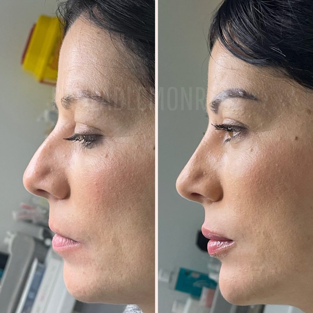 487216875_17984351069803477_5695465774071943420_n-r6kohdeq7vmwkk8sj1v2cwy91mm5fg4416abtcsz68