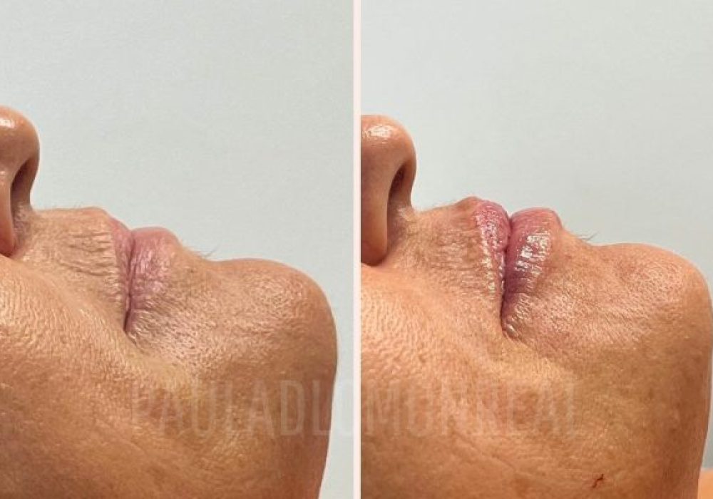 468337052_17969372189803477_7913309624197051907_n-r6koic6mdbrn4xirk62nwn4u3u3t5g4xrt2xx2ekkg