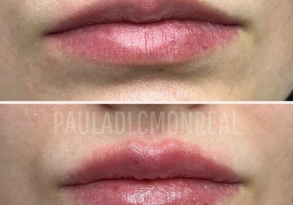 473777061_17975714636803477_8691855152350433611_n-r6koi2s8gzerwtwf320e7pi85ze50h3meik34asiao